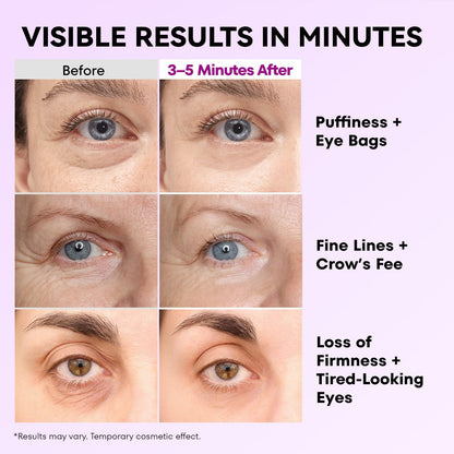 Instant Eye Lift Cream